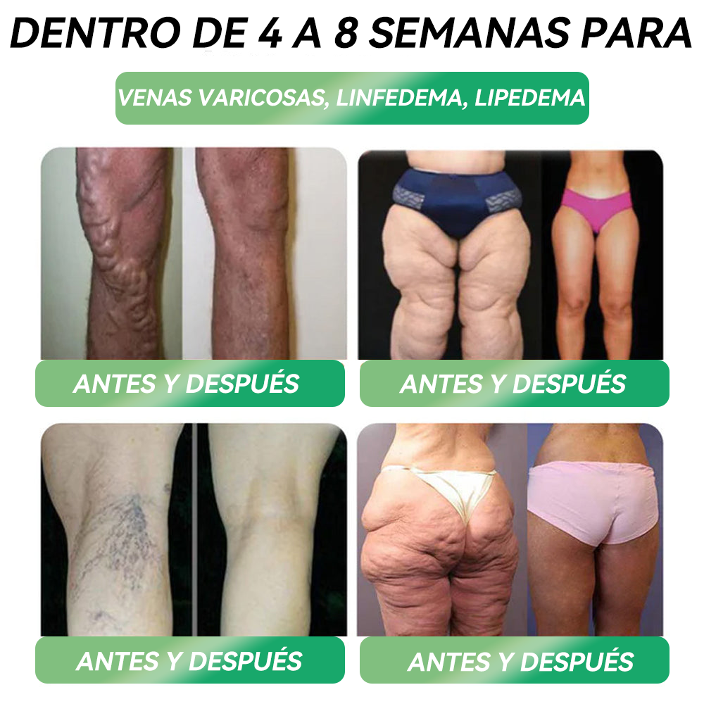 𝐓𝐢𝐞𝐧𝐝𝐚 𝐎𝐟𝐢𝐜𝐢𝐚𝐥 🌿| 𝐻𝐻𝑉𝐵® 𝐆𝐋𝐏-𝟏 𝐒𝐨𝐥𝐮𝐜𝐢ó𝐧 𝐎𝐫𝐚𝐥 𝐩𝐚𝐫𝐚 𝐥𝐚 𝐏é𝐫𝐝𝐢𝐝𝐚 𝐝𝐞 𝐏𝐞𝐬𝐨 - 🌟 𝐎𝐛𝐞𝐬𝐢𝐝𝐚𝐝, 𝐄𝐧𝐟𝐞𝐫𝐦𝐞𝐝𝐚𝐝𝐞𝐬 𝐂𝐚𝐫𝐝𝐢𝐨𝐯𝐚𝐬𝐜𝐮𝐥𝐚𝐫𝐞𝐬, 𝐃𝐢𝐚𝐛𝐞𝐭𝐞𝐬, 𝐀𝐩𝐧𝐞𝐚 𝐝𝐞𝐥 𝐒𝐮𝐞ñ𝐨, 𝐏𝐫𝐨𝐛𝐥𝐞𝐦𝐚𝐬 𝐝𝐞 𝐀𝐫𝐭𝐢𝐜𝐮𝐥𝐚𝐜𝐢𝐨𝐧𝐞𝐬 𝐲 𝐌á𝐬